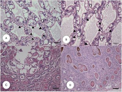 Differentially Expressed Genes in Hepatopancreas of Acute Hepatopancreatic Necrosis Disease Tolerant and Susceptible Shrimp (Penaeus vannamei)